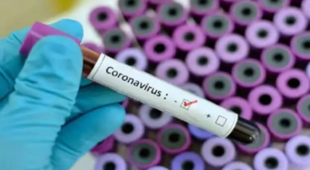 हिमाचल में तीन कोरोना संक्रमितों की मौत, 859 नए पॉजिटिव मरीज